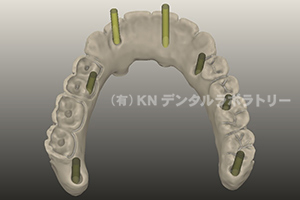 スキャナー＆CAD